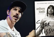 Anthony Kiedis