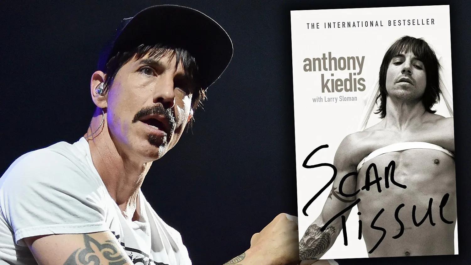 Anthony Kiedis
